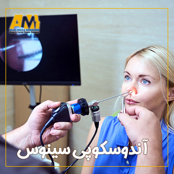 آندوسکوپی سینوس + دکتر علیرضا محبی
