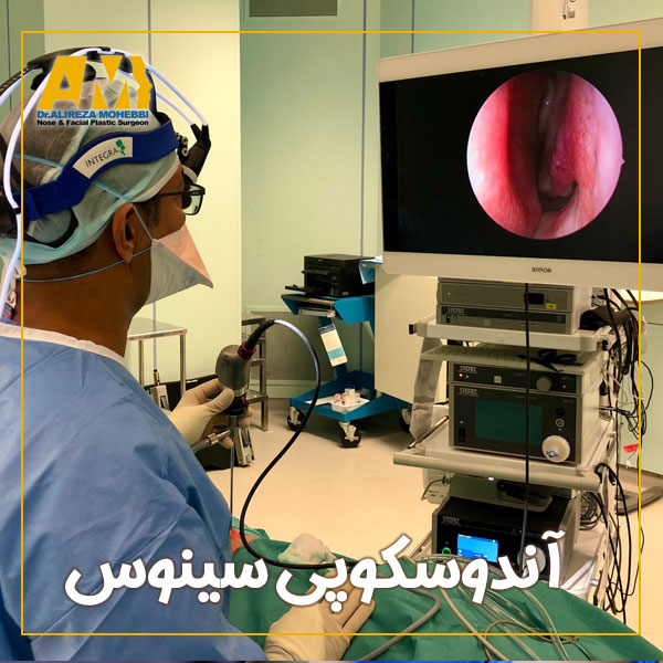 آندوسکوپی سینوس + دکتر علیرضا محبی