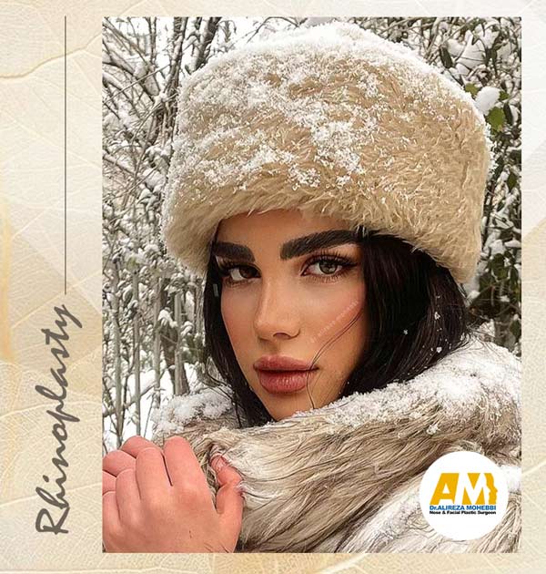 جراحی بینی - دکتر محبی