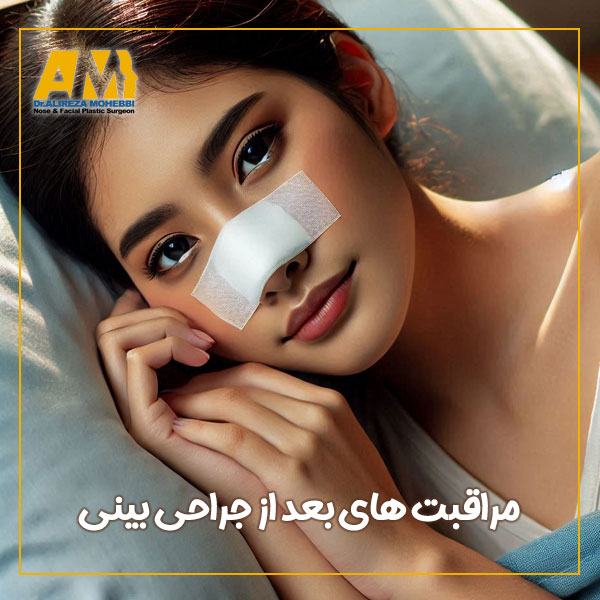 مراقبت های بعد از جراحی بینی - دکتر علیرضا محبی