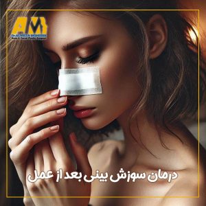 سوزش بینی بعد از عمل - دکتر علیرضا محبی