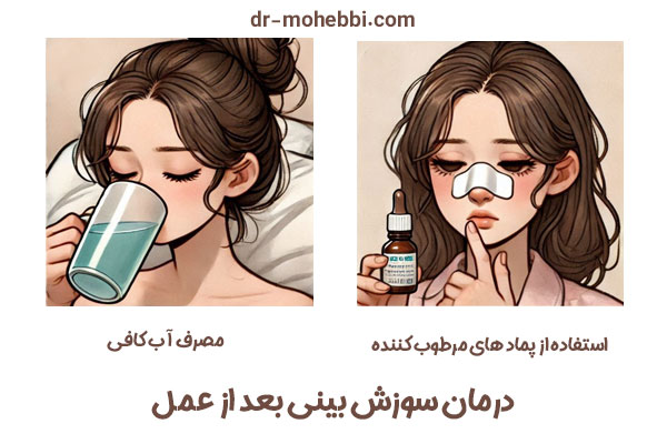 سوزش بینی بعد از عمل - دکتر علیرضا محبی