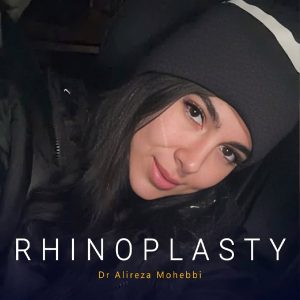 جراحی بینی فانتزی + دکتر علیرضا محبی