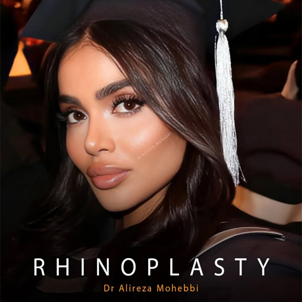 جراحی بینی گوشتی در تهران + دکتر علیرضا محبی