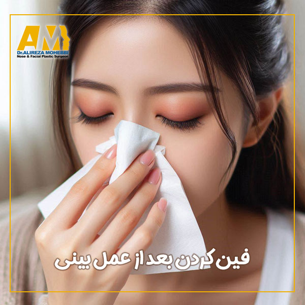 فین کردن بعد از عمل بینی + دکتر علیرضا محبی