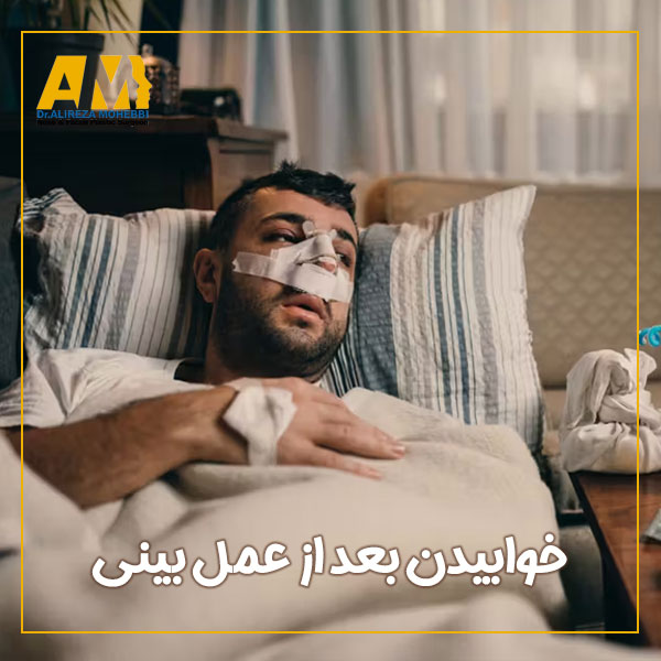 خوابیدن بعد از عمل بینی یکی + دکتر علیرضا محبی