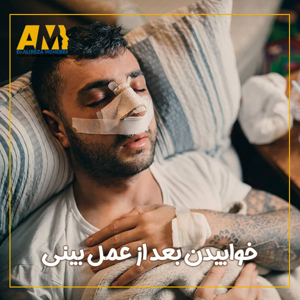خوابیدن بعد از عمل بینی یکی + دکتر علیرضا محبی