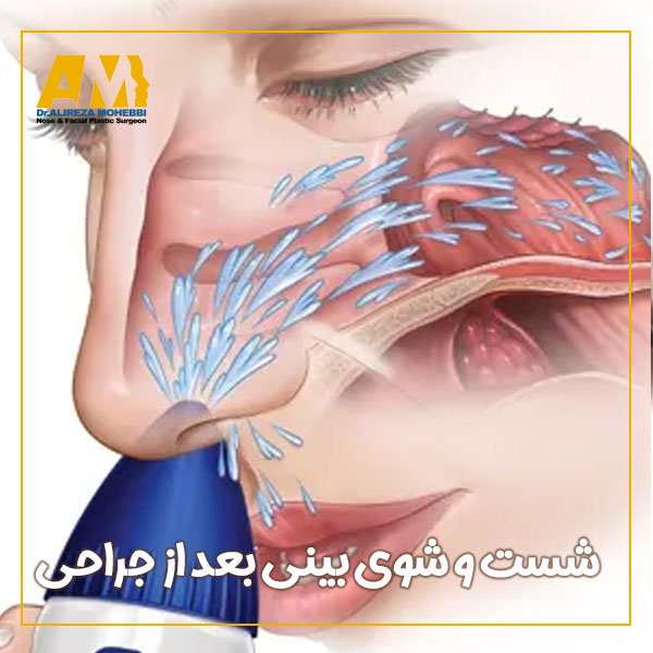 شست و شوی بینی بعد از عمل + دکتر علیرضا محبی