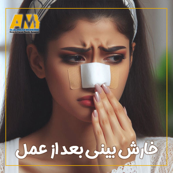 خارش بینی بعد از عمل + دکتر علیرضا محبی