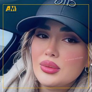 بهترین جراح بینی تهران دکتر علیرضا محبی