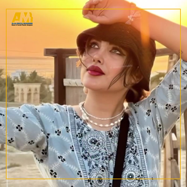 بهترین جراح بینی تهران دکتر علیرضا محبی