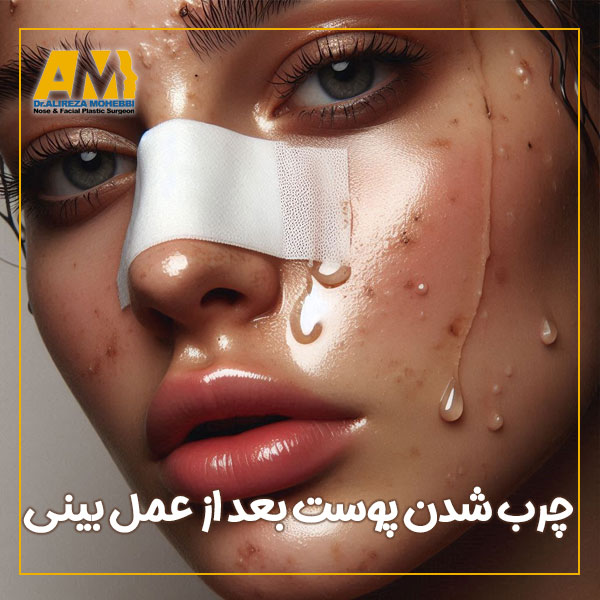 چرب شدن پوست بعد از عمل بینی + دکتر علیرضا محبی