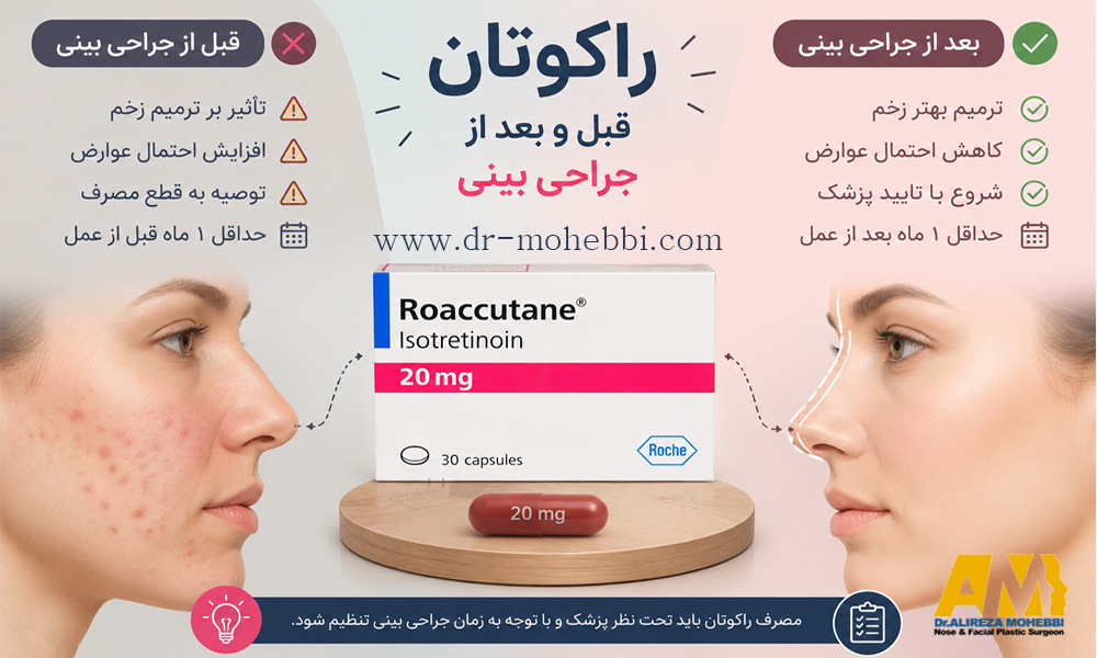 راکوتان قبل و بعد از جراحی بینی - دکتر علیرضا محبی