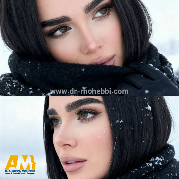 بهترین جراح بینی تهران + دکتر علیرضا محبی