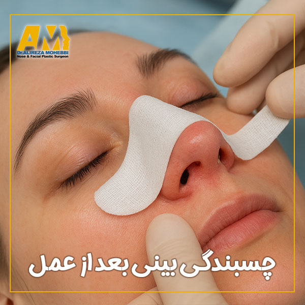 چسبندگی بینی بعد از عمل + دکتر علیرضا محبی
