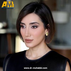 بهترین جراح بینی تهران دکتر علیرضا محبی