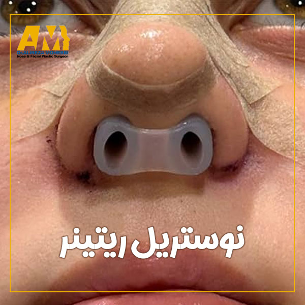 نوستریل ریتینر + دکتر علیرضا محبی