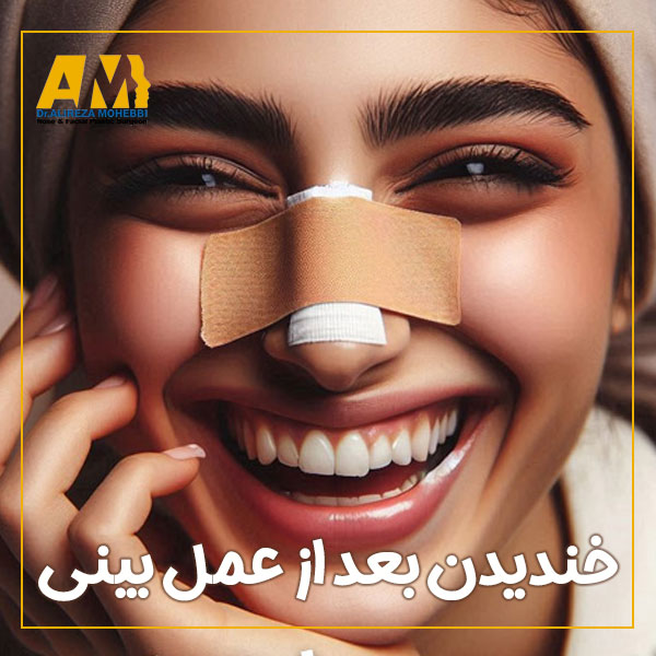 خندیدن بعد از عمل بینی + دکتر علیرضا محبی