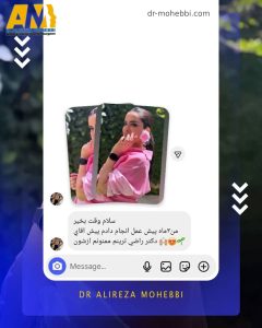 نمونه کار جراحی زیبایی بینی 