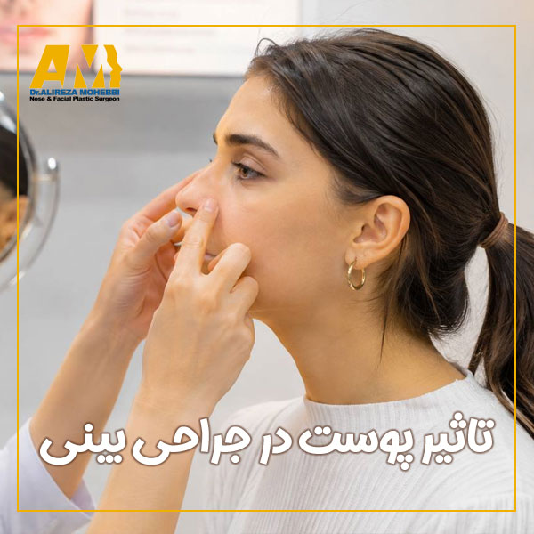تاثیر پوست در جراحی بینی + دکتر علیرضا محبی