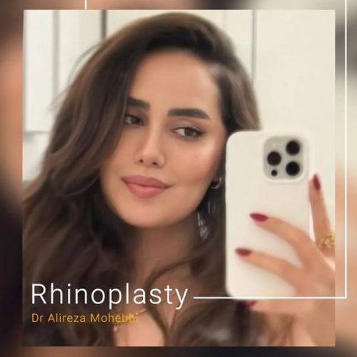 Rhinoplasty-130