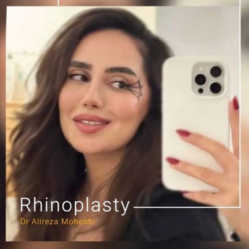 Rhinoplasty-131