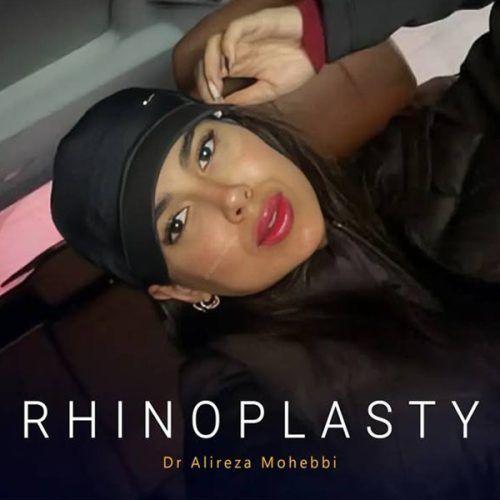 Rhinoplasty-153