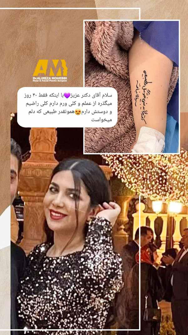 جراحی بینی طبیعی