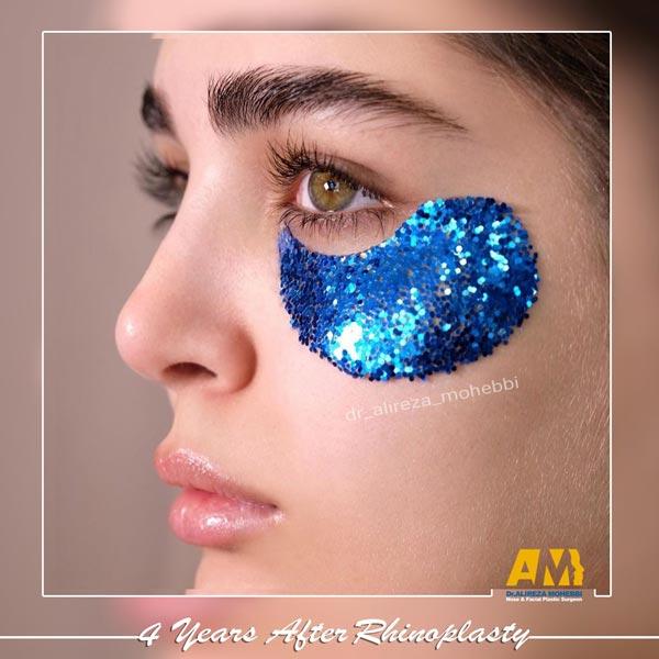 جراحی بینی دکتر محبی