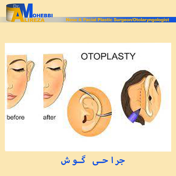 جراحی گوش - دکتر محبی