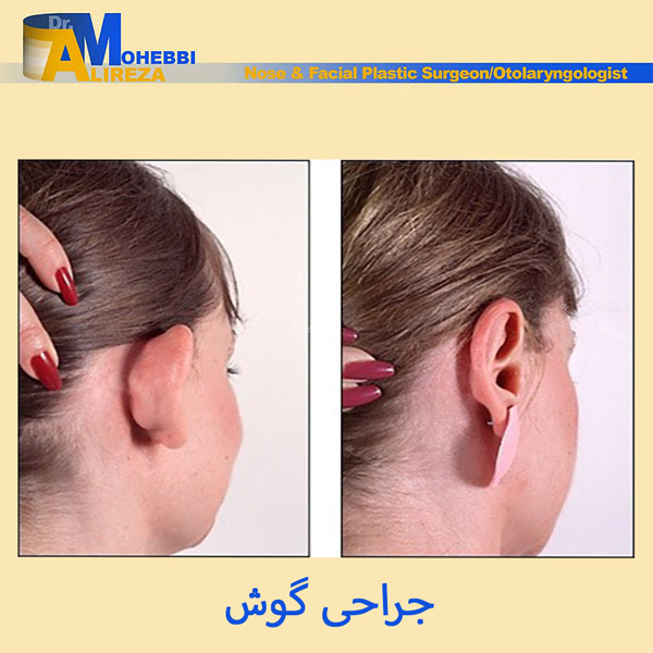 جراحی گوش در تهران - دکتر محبی