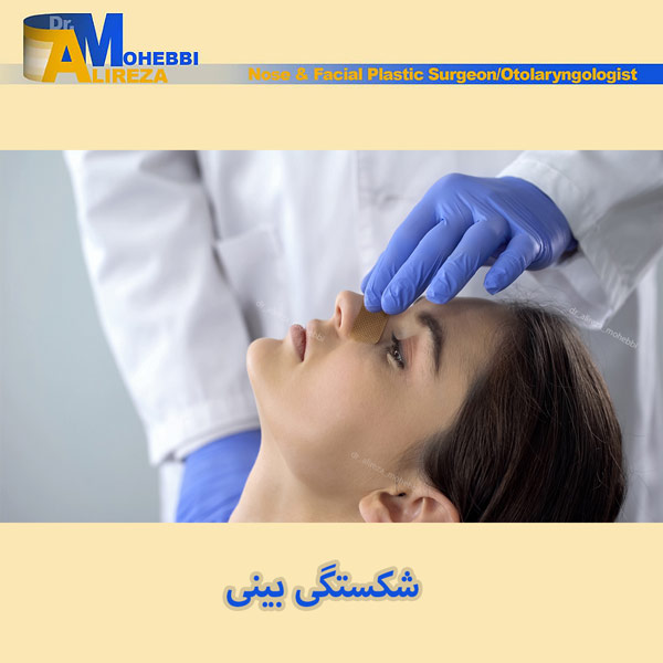 شکستگی بینی - دکتر علیرضا محبی