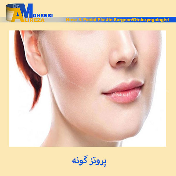 پروتز گونه - دکتر محبی